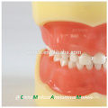 24pcs Removable Teeth Children Standard Dental Model 13003